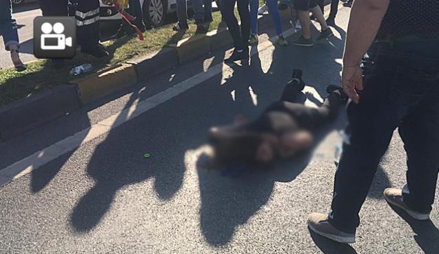 Kazada yaralandı... ANNEMİ İSTİYORUM Dedi...