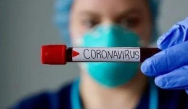 Covid-19 can kayıpları sürüyor