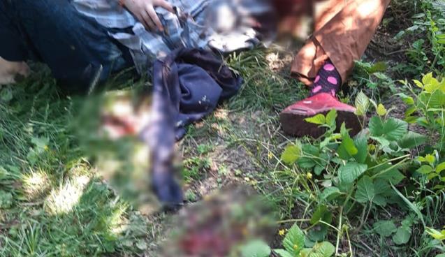 Kafasına İki El Sıktı.