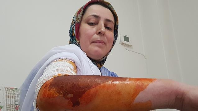 Cani koca misafirin yanında oturmadı diye eşini kaynar su